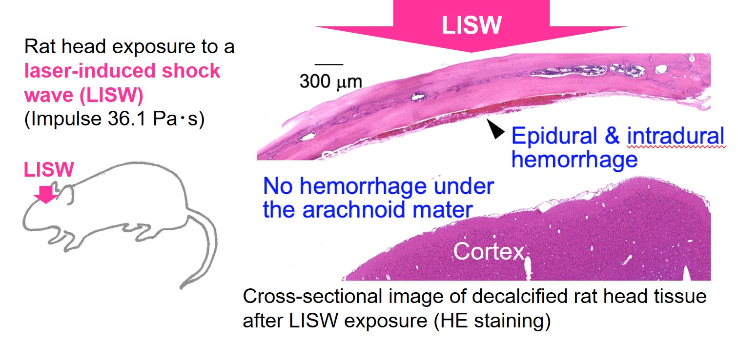 Figure 7 Meningeal damage in the rat after LISW exposure